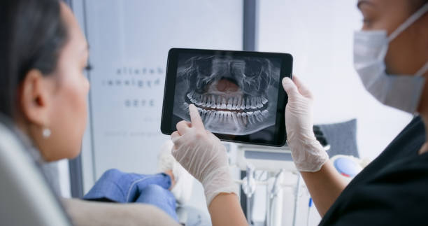 Licensed Tooth Extraction service in Petaluma, CA - Smile Center Dentistry